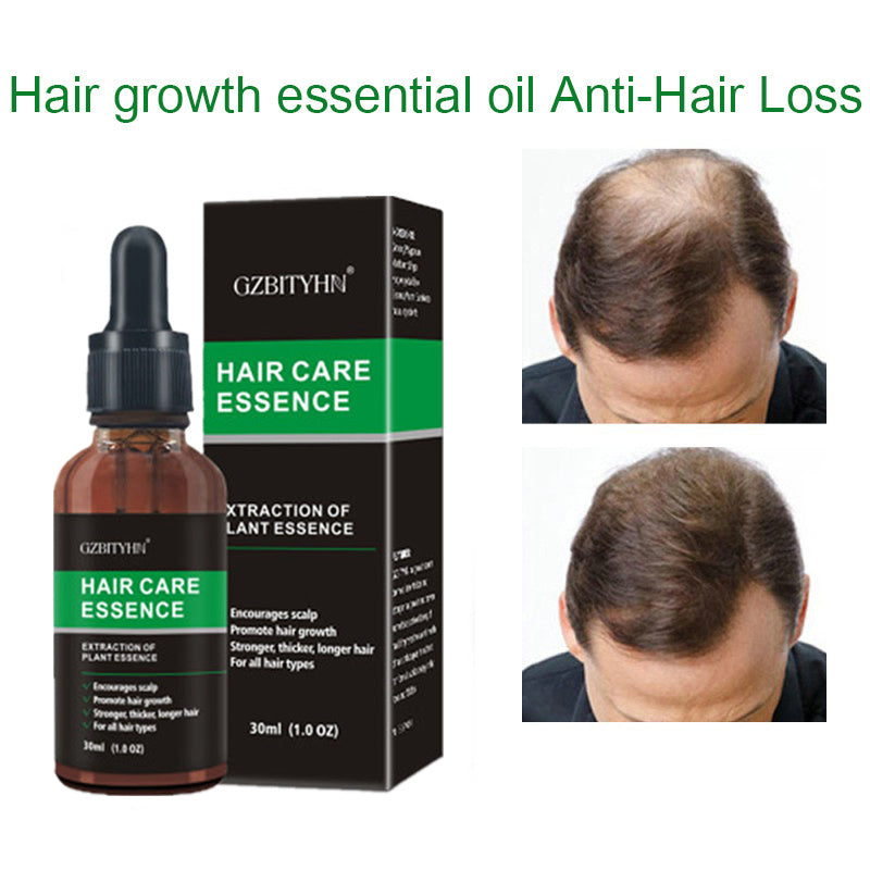 Hair Growth & Scalp Nourishing Oil โ Essential Oil for Stronger, Thicker Hair (30ml)