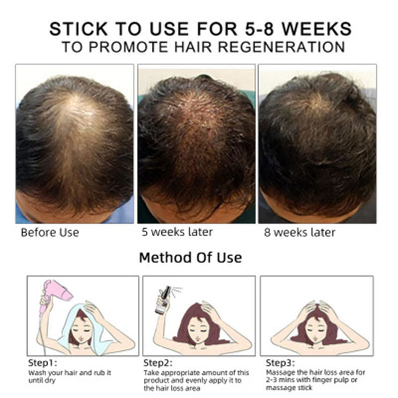 Hair Growth & Scalp Nourishing Oil – Essential Oil for Stronger, Thicker Hair (30ml)