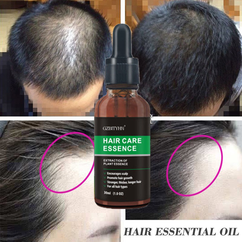Hair Growth & Scalp Nourishing Oil – Essential Oil for Stronger, Thicker Hair (30ml)