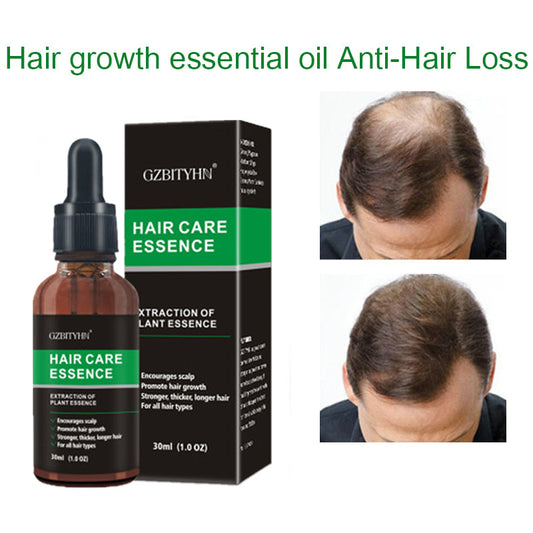Hair Growth & Scalp Nourishing Oil – Essential Oil for Stronger, Thicker Hair (30ml)